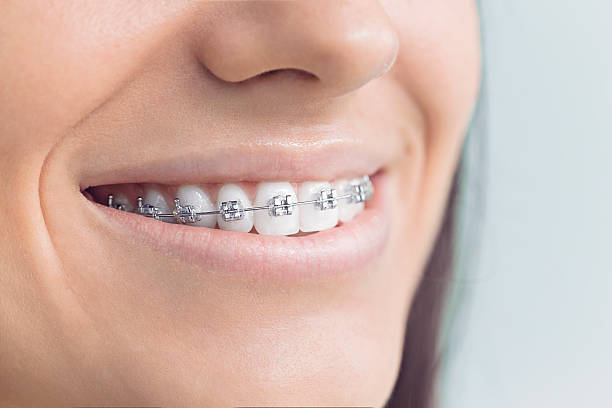 Best Dental Bonding  in Somerville, NJ